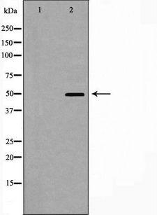 CRFR1 / CRHR1 Antibody - Western blot analysis of CRHR1 expression in HT29 cells. The lane on the left is treated with the antigen-specific peptide.