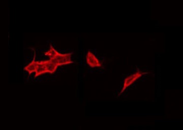 CRFR1 / CRHR1 Antibody - Staining HT29 cells by IF/ICC. The samples were fixed with PFA and permeabilized in 0.1% Triton X-100, then blocked in 10% serum for 45 min at 25°C. The primary antibody was diluted at 1:200 and incubated with the sample for 1 hour at 37°C. An Alexa Fluor 594 conjugated goat anti-rabbit IgG (H+L) Ab, diluted at 1/600, was used as the secondary antibody.