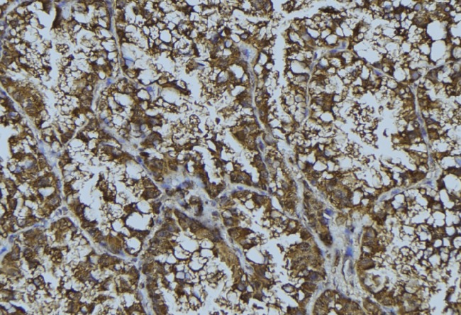 CRFR1 / CRHR1 Antibody - 1:100 staining mouse testis tissue by IHC-P. The sample was formaldehyde fixed and a heat mediated antigen retrieval step in citrate buffer was performed. The sample was then blocked and incubated with the antibody for 1.5 hours at 22°C. An HRP conjugated goat anti-rabbit antibody was used as the secondary.