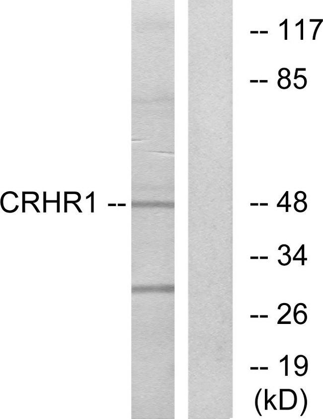 CRFR1 / CRHR1 Antibody - Western blot analysis of extracts from HT-29 cells, using CRHR1 antibody.