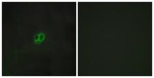 CRFR1 / CRHR1 Antibody - Peptide - + Immunofluorescence analysis of MCF-7 cells, using CRHR1 antibody.