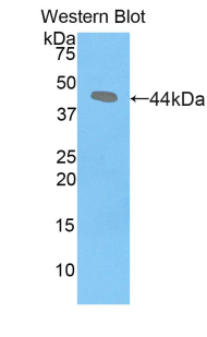 CRH / CRF Antibody - Western blot of CRH / CRF antibody.