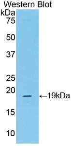 CRH / CRF Antibody - Western blot of CRH / CRF antibody.