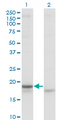 CRH / CRF Antibody - Western Blot analysis of CRH expression in transfected 293T cell line by CRH monoclonal antibody (M02), clone 2B11.Lane 1: CRH transfected lysate(21.4 KDa).Lane 2: Non-transfected lysate.