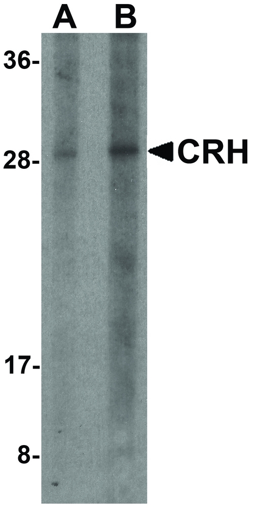 CRH / CRF Antibody - Western blot analysis of CRH in human placenta tissue lysate with CRH antibody at (A) 1 and (B) 2 ug/ml.