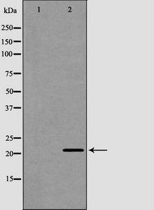 CRH / CRF Antibody - Western blot analysis of human brain lysate using CRH antibody. The lane on the left is treated with the antigen-specific peptide.