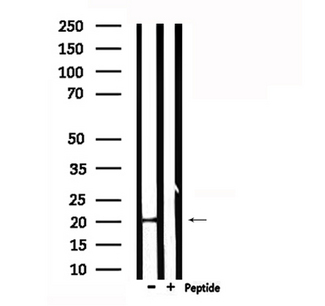 CRH / CRF Antibody - Western blot analysis of extracts of various samples using CRH antibody. Lane 1: HuvEc; Lane 2: 293;