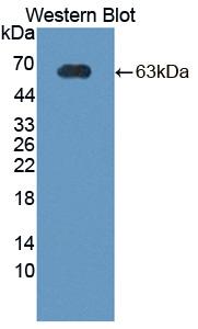 CRHBP Antibody - Western blot of CRHBP antibody.