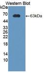 CRHBP Antibody - Western blot of CRHBP antibody.