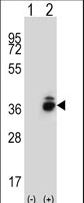 CRHBP Antibody - Western blot of CRHBP (arrow) using rabbit polyclonal CRHBP Antibody. 293 cell lysates (2 ug/lane) either nontransfected (Lane 1) or transiently transfected (Lane 2) with the CRHBP gene.