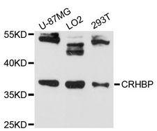 CRHBP Antibody - Western blot analysis of extracts of various cell lines, using CRHBP antibody at 1:3000 dilution. The secondary antibody used was an HRP Goat Anti-Rabbit IgG (H+L) at 1:10000 dilution. Lysates were loaded 25ug per lane and 3% nonfat dry milk in TBST was used for blocking. An ECL Kit was used for detection and the exposure time was 30s.