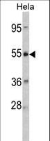 CRHR2 / CRF2 Receptor Antibody - Western blot of CRHR2 Antibody in HeLa cell line lysates (35 ug/lane). CRHR2 (arrow) was detected using the purified antibody.