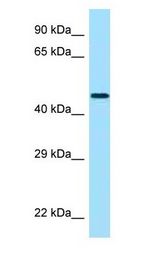 CRHR2 / CRF2 Receptor Antibody - CRHR2 / CRF2 antibody Western Blot of Fetal Brain.  This image was taken for the unconjugated form of this product. Other forms have not been tested.