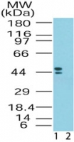 CRHR2 / CRF2 Receptor Antibody - Western blot of CRHR2 in human brain lysate in the 1) absence and 2) presence of immunizing peptide using Polyclonal Antibody toCorticotropin-Releasing Hormone Receptor 2/CRHR2 at 1 ug/ml. Both of the isoforms detected by Polyclonal Antibody toCorticotropin-Releasing Hormone Receptor 2/CRHR2 are blocked by the immunizing peptide.