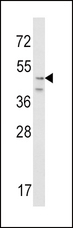CRHR2 / CRF2 Receptor Antibody - Western blot of CRHR2 Antibody in NIH-3T3 cell line lysates (35 ug/lane). CRHR2 (arrow) was detected using the purified antibody.