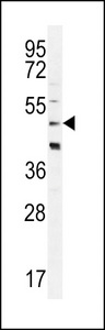 CRHR2 / CRF2 Receptor Antibody - CRFR2D Antibody western blot of HeLa cell line lysates (35 ug/lane). The CRFR2D antibody detected the CRFR2D protein (arrow).
