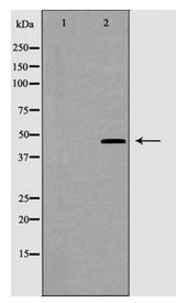 CRHR2 / CRF2 Receptor Antibody - Western blot of CRFR2 expression in K562 cells