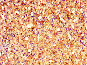 CRHR2 / CRF2 Receptor Antibody - Immunohistochemistry image of paraffin-embedded human adrenal gland tissue at a dilution of 1:100