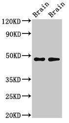 CRHR2 / CRF2 Receptor Antibody - Positive Western Blot detected in Rat brain tissue, Mouse brain tissue. All lanes: CRHR2 antibody at 3 µg/ml Secondary Goat polyclonal to rabbit IgG at 1/50000 dilution. Predicted band size: 48, 51, 47, 45, 43 KDa. Observed band size: 34 KDa