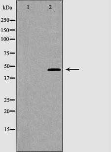 CRHR2 / CRF2 Receptor Antibody - Western blot analysis of CRFR2 expression in K562 cells. The lane on the left is treated with the antigen-specific peptide.