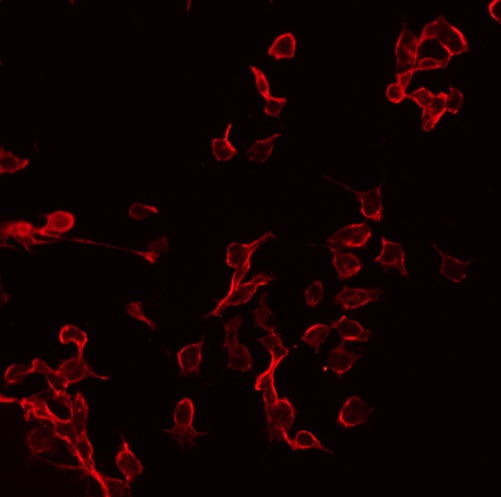 CRHR2 / CRF2 Receptor Antibody - Staining COLO205 cells by IF/ICC. The samples were fixed with PFA and permeabilized in 0.1% Triton X-100, then blocked in 10% serum for 45 min at 25°C. The primary antibody was diluted at 1:200 and incubated with the sample for 1 hour at 37°C. An Alexa Fluor 594 conjugated goat anti-rabbit IgG (H+L) Ab, diluted at 1/600, was used as the secondary antibody.