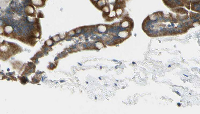 CRHR2 / CRF2 Receptor Antibody - 1:100 staining mouse intestine tissue by IHC-P. The sample was formaldehyde fixed and a heat mediated antigen retrieval step in citrate buffer was performed. The sample was then blocked and incubated with the antibody for 1.5 hours at 22°C. An HRP conjugated goat anti-rabbit antibody was used as the secondary.