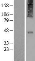 CRHR2 / CRF2 Receptor Protein - Western validation with an anti-DDK antibody * L: Control HEK293 lysate R: Over-expression lysate