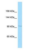 CRIM1 Antibody - CRIM1 antibody Western Blot of Jurkat.  This image was taken for the unconjugated form of this product. Other forms have not been tested.