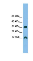 CRIP1 Antibody - CRIP1 / CRIP antibody Western blot of THP-1 cell lysate. This image was taken for the unconjugated form of this product. Other forms have not been tested.