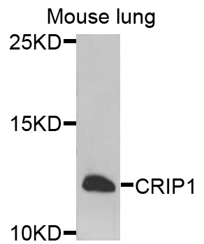 CRIP1 Antibody - Western blot analysis of extracts of mouse lung cells.