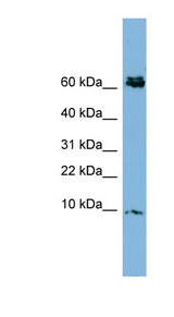 CRIP1 Antibody - CRIP1 / CRIP antibody western blot of PANC1 cell lysate.  This image was taken for the unconjugated form of this product. Other forms have not been tested.