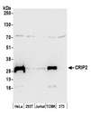 CRIP2 Antibody - Detection of human and mouse CRIP2 by western blot. Samples: Whole cell lysate (50 µg) from HeLa, HEK293T, Jurkat, mouse TCMK-1, and mouse NIH 3T3 cells prepared using NETN lysis buffer. Antibody: Affinity purified rabbit anti-CRIP2 antibody used for WB at 1:1000. Detection: Chemiluminescence with an exposure time of 30 seconds.