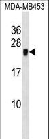CRIP2 Antibody - CRIP2 Antibody western blot of MDA-MB453 cell line lysates (35 ug/lane). The CRIP2 antibody detected the CRIP2 protein (arrow).