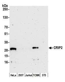 CRIP2 Antibody - Detection of human and mouse CRIP2 by western blot. Samples: Whole cell lysate (50 µg) from HeLa, HEK293T, Jurkat, mouse TCMK-1, and mouse NIH 3T3 cells prepared using NETN lysis buffer. Antibody: Affinity purified rabbit anti-CRIP2 antibody used for WB at 1:1000. Detection: Chemiluminescence with an exposure time of 3 minutes.
