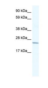 CRIP2 Antibody - CRIP2 antibody Western blot of Placenta lysate. This image was taken for the unconjugated form of this product. Other forms have not been tested.