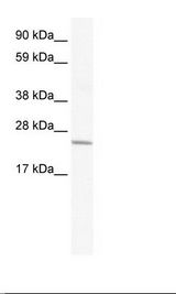 CRIP2 Antibody - Placenta Lysate.  This image was taken for the unconjugated form of this product. Other forms have not been tested.