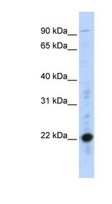 CRIP2 Antibody - CRIP2 antibody Western blot of MCF7 cell lysate. This image was taken for the unconjugated form of this product. Other forms have not been tested.