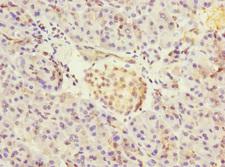 CRIP2 Antibody - Immunohistochemistry of paraffin-embedded human pancreatic tissue at dilution 1:100