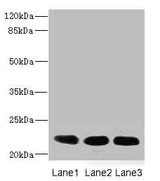 CRIP2 Antibody - Western blot All Lanes: CRIP2 antibody at 4.68ug/ml Lane 1: Ret heart tissue Lane 2: Mouse lung tissue Lane 3: MCF7 whole cell lysate Secondary Goat polyclonal to rabbit IgG at 1/10000 dilution Predicted band size: 23,31 kDa Observed band size: 22 kDa