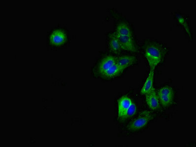 CRIP2 Antibody - Immunofluorescent analysis of Hela cells diluted at 1:100 and Alexa Fluor 488-congugated AffiniPure Goat Anti-Rabbit IgG(H+L)