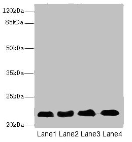 CRIP2 Antibody - Western blot All Lanes: CRIP2 antibody at 5.93ug/ml Lane 1: Ret heart tissue Lane 2: Mouse lung tissue Lane 3: Hela whole cell lysate Lane 4: MCF7 whole cell lysate Secondary Goat polyclonal to rabbit IgG at 1/10000 dilution Predicted band size: 23,31 kDa Observed band size: 22 kDa