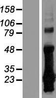 CRIP2 Protein - Western validation with an anti-DDK antibody * L: Control HEK293 lysate R: Over-expression lysate