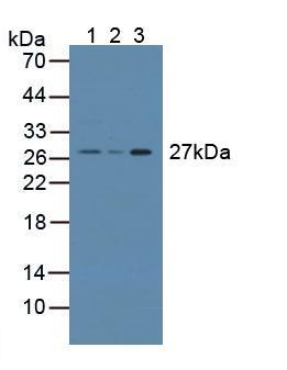 CRISP1 Antibody - Western Blot; Sample: Lane1: Mouse Testis Tissue; Lane2: Rat Prostate Gland Tissue; Lane3: Rat Testis Tissue.