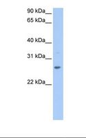 CRISP1 Antibody - 721_B cell lysate. Antibody concentration: 1.0 ug/ml. Gel concentration: 12%.  This image was taken for the unconjugated form of this product. Other forms have not been tested.