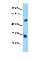 CRISP1 Antibody - CRISP1 antibody Western blot of HepG2 Cell lysate. Antibody concentration 1 ug/ml.  This image was taken for the unconjugated form of this product. Other forms have not been tested.