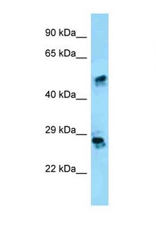 CRISP1 Antibody - CRISP1 antibody Western blot of HepG2 Cell lysate. Antibody concentration 1 ug/ml.  This image was taken for the unconjugated form of this product. Other forms have not been tested.
