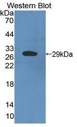 CRISP2 / TSP1 Antibody - Western blot of CRISP2 / TSP1 antibody using a recombinant protein encoding amino acids 20-224.