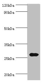 CRISP2 / TSP1 Antibody - Western blot All lanes: CRISP2 antibody at 12µg/ml + Rat gonad tissue Secondary Goat polyclonal to rabbit IgG at 1/10000 dilution Predicted band size: 28, 32 kDa Observed band size: 28 kDa