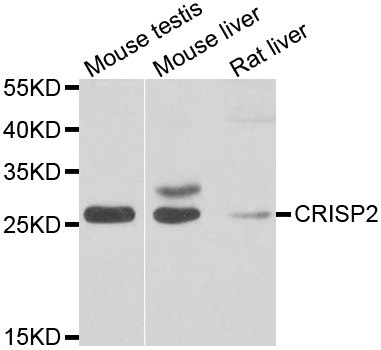 CRISP2 / TSP1 Antibody - Western blot analysis of extracts of various cell lines.