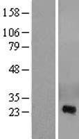 CRISP2 / TSP1 Protein - Western validation with an anti-DDK antibody * L: Control HEK293 lysate R: Over-expression lysate